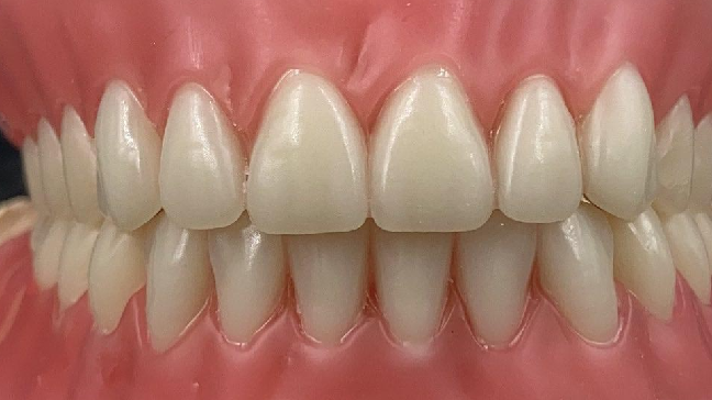 MYY Dental Lab -China Outsourcing Dental Laboratory